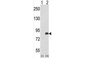 Image no. 2 for anti-Adrenergic, Beta, Receptor Kinase 2 (ADRBK2) (AA 36-65), (N-Term) antibody (ABIN950649)