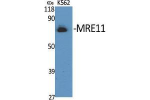Image no. 2 for anti-MRE11 Meiotic Recombination 11 Homolog A (S. Cerevisiae) (MRE11A) (Ser916) antibody (ABIN3185627)