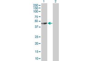 Image no. 1 for anti-Melanoma Antigen Family A, 4 (MAGEA4) (AA 1-317) antibody (ABIN517689)
