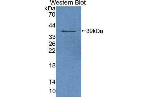 anti-Protein tyrosine Phosphatase, Non-Receptor Type 9 (PTPN9) (AA 289-593) antibody