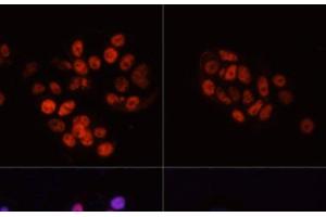 POLR2A/RPB1 antibody  (pSer5)