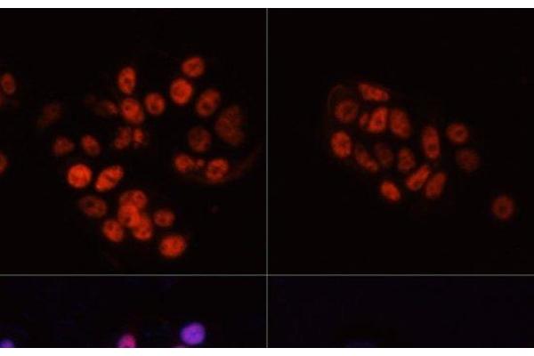 POLR2A/RPB1 antibody  (pSer5)
