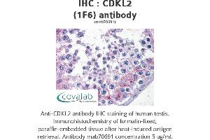Image no. 1 for anti-Cyclin Dependent Kinase Like 2 (CDKL2) (AA 394-493) antibody (ABIN1723548)