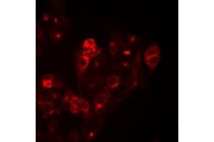 Image no. 1 for anti-serine Peptidase Inhibitor, Kunitz Type 1 (SPINT1) (full length) antibody (ABIN6006130)