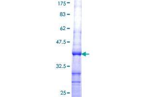 Image no. 1 for Coproporphyrinogen Oxidase (CPOX) (AA 356-453) protein (GST tag) (ABIN1350225)