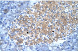 Image no. 3 for anti-Protein Inhibitor of Activated STAT, 2 (PIAS2) (C-Term) antibody (ABIN2779873)