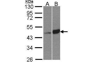 Image no. 2 for anti-Branched Chain Ketoacid Dehydrogenase Kinase (BCKDK) (Center) antibody (ABIN2855837)