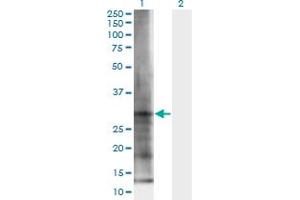 Image no. 1 for anti-Elastase 3B, Pancreatic (ELA3B) (AA 19-270) antibody (ABIN949113)