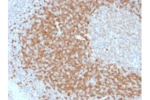 Image no. 4 for anti-T-Cell Leukemia/lymphoma 1A (TCL1A) (AA 2-109) antibody (ABIN6940948)