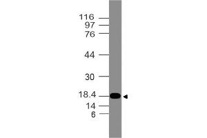 Image no. 1 for anti-Filaggrin Family Member 1 (FLG1) (AA 1-300) antibody (ABIN5027200)