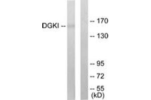 Image no. 1 for anti-Diacylglycerol Kinase, iota (DGKI) (AA 991-1040) antibody (ABIN1533547)