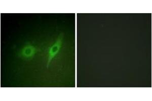Image no. 2 for anti-Collagen, Type IV, alpha 2 (COL4A2) (AA 151-200) antibody (ABIN1534338)