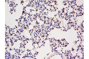Image no. 2 for anti-Immunoglobulin (CD79A) Binding Protein 1 (IGBP1) (AA 151-250) antibody (ABIN727578)