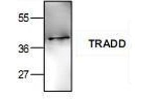 Image no. 1 for anti-TNFRSF1A-Associated Via Death Domain (TRADD) antibody (ABIN223257)