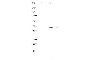 Image no. 1 for anti-E2F Transcription Factor 1 (E2F1) (pThr433) antibody (ABIN6256563)
