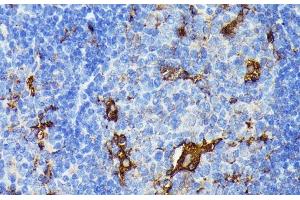 Immunohistochemistry of paraffin-embedded Mouse spleen using TIAL1 Polyclonal Antibody at dilution of 1:100 (40x lens).