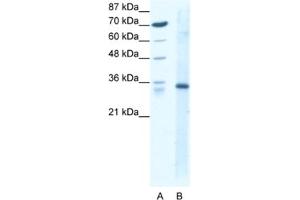 Image no. 1 for anti-Kruppel-Like Factor 3 (Basic) (KLF3) antibody (ABIN2460389)