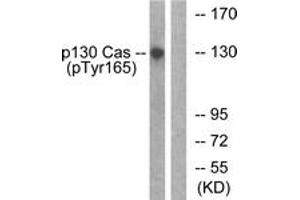 Western blot analysis of extracts from HepG2 cells treated with EGF 200ng/ml 30', using p130 Cas (Phospho-Tyr165) Antibody.