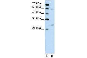 Image no. 1 for anti-Guanidinoacetate N-Methyltransferase (GAMT) (N-Term) antibody (ABIN631157)