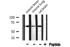 Image no. 4 for anti-CDK5 Regulatory Subunit Associated Protein 1-Like 1 (CDKAL1) antibody (ABIN6259603)