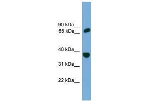 Image no. 1 for anti-Protection of Telomeres 1 (POT1) (Middle Region) antibody (ABIN2787632)