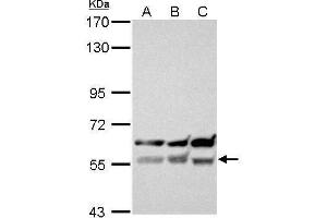 WB Image XIAP antibody [C1C3] detects XIAP protein by Western blot analysis.