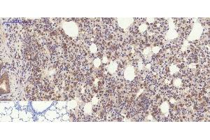 Immunohistochemistry of paraffin-embedded Rat lung tissue using YAP1 Polyclonal Antibody at dilution of 1:200.
