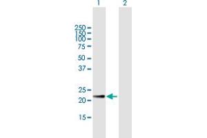 Image no. 2 for anti-V-Crk Sarcoma Virus CT10 Oncogene Homolog (Avian) (CRK) (AA 1-204) antibody (ABIN514601)