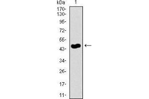 Image no. 3 for anti-Guanylate Cyclase 1 Soluble Subunit Alpha (GUCY1A1) (AA 22-214) antibody (ABIN1724788)