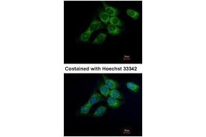 Image no. 3 for anti-Hydroxysteroid (17-Beta) Dehydrogenase 4 (HSD17B4) (Center) antibody (ABIN2855717)