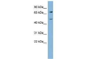 Image no. 1 for anti-Glutamine-Fructose-6-Phosphate Transaminase 2 (GFPT2) (Middle Region) antibody (ABIN2775298)