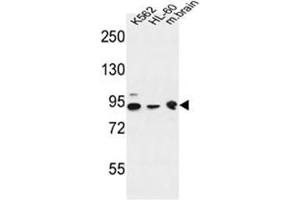anti-DnaJ (Hsp40) Homolog, Subfamily C, Member 6 (DNAJC6) (AA 260-290), (Middle Region) antibody