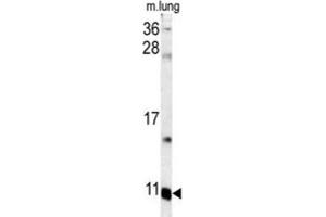 Image no. 1 for anti-S100 Calcium Binding Protein A6 (S100A6) antibody (ABIN3003159)