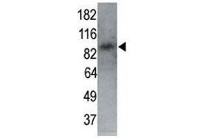 Image no. 2 for anti-MAP/microtubule Affinity-Regulating Kinase 1 (MARK1) (AA 6-40) antibody (ABIN3031687)