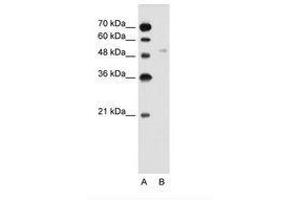 Image no. 2 for anti-Solute Carrier Family 2 (Facilitated Glucose Transporter), Member 6 (SLC2A6) (AA 351-400) antibody (ABIN205018)