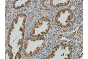 Image no. 1 for anti-N-Myc Downstream Regulated 1 (NDRG1) (AA 1-394) antibody (ABIN564518)