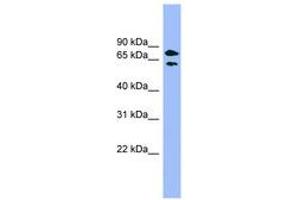 Image no. 1 for anti-Pantothenate Kinase 4 (PANK4) (AA 359-408) antibody (ABIN6744130)