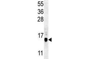 Image no. 2 for anti-Microtubule-Associated Protein 1 Light Chain 3 beta (MAP1LC3B) (AA 74-106) antibody (ABIN3029739)
