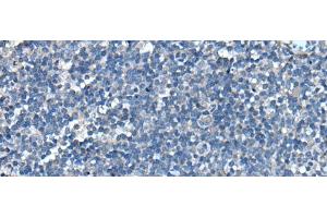 Immunohistochemistry of paraffin-embedded Human tonsil tissue using UFC1 Polyclonal Antibody at dilution of 1:50(x200)