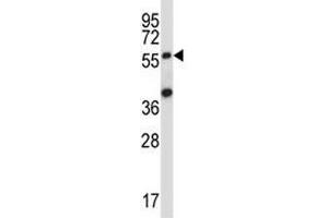 Image no. 2 for anti-Suppressor of Cytokine Signaling 6 (SOCS6) (AA 40-69) antibody (ABIN3029048)