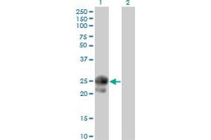anti-BMP and Activin Membrane-Bound Inhibitor Homolog (BAMBI) (AA 1-260) antibody