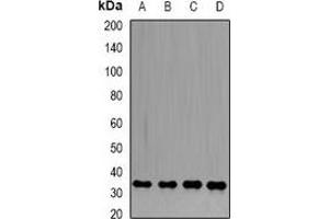 Image no. 3 for anti-Serine/threonine-Protein Phosphatase PP1-beta Catalytic Subunit (PP1-BETA) antibody (ABIN2966918)
