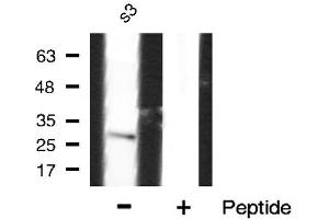 Image no. 2 for anti-Interleukin 1, beta (IL1B) (Internal Region) antibody (ABIN6262623)