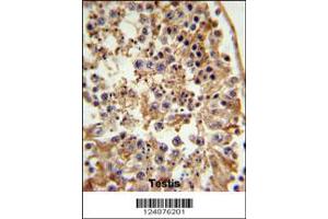 Image no. 2 for anti-Fanconi Anemia, Complementation Group C (FANCC) (AA 527-555), (C-Term) antibody (ABIN653475)