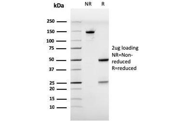 anti-Estrogen Receptor 1 (ESR1) (AA 129-312) antibody