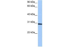 Image no. 1 for anti-Ankyrin Repeat and SOCS Box-Containing 11 (ASB11) (C-Term) antibody (ABIN632206)