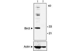 Image no. 1 for anti-Bridging Integrator 3 (BIN3) antibody (ABIN1043741)