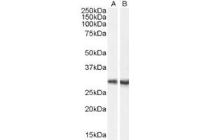 Image no. 1 for anti-Carboxylesterase 4A (CES4A) (C-Term) antibody (ABIN2790977)