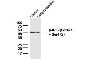 Image no. 2 for anti-Interferon Regulatory Factor 7 (IRF7) (pSer471), (pSer472) antibody (ABIN742703)