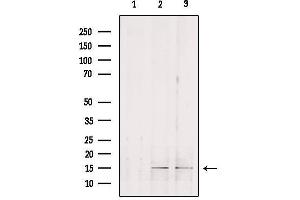 Image no. 2 for anti-Golgi Transport 1B (GOLT1B) antibody (ABIN6262032)